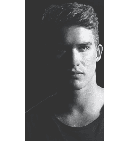 IMPLANTE CAPILAR Cuero Cabelludo - 2.000 Folículos