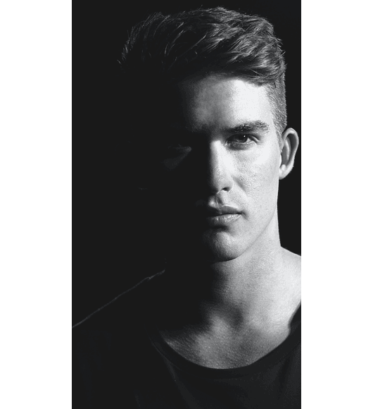 IMPLANTE CAPILAR Cuero Cabelludo - 3.000 Folículos