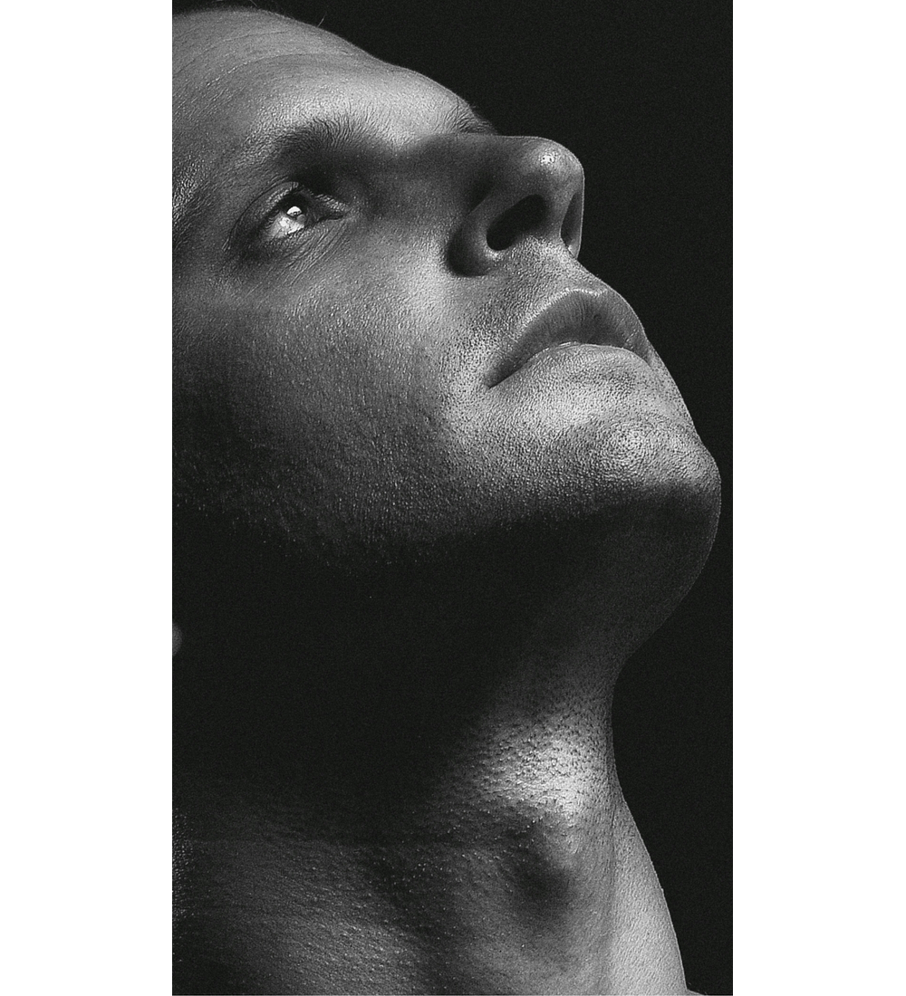 IMPLANTE CAPILAR BARBA | 1.500 Foliculos