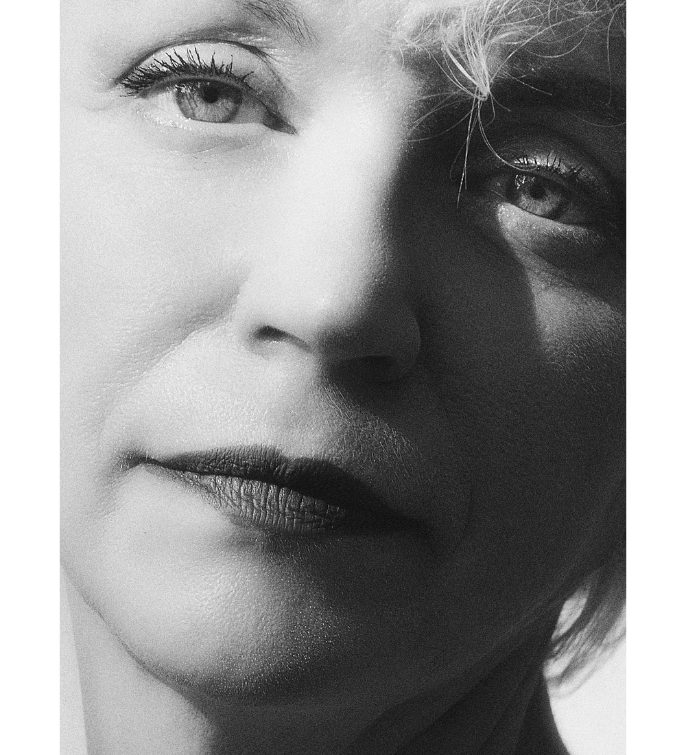 BLEFAROPLASTIA INFERIOR