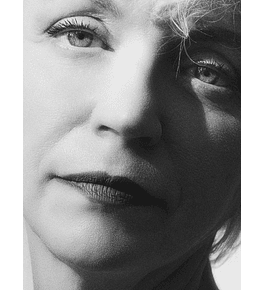 BLEFAROPLASTIA INFERIOR