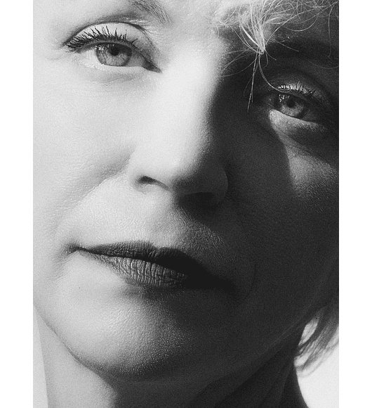 BLEFAROPLASTIA INFERIOR