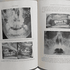 Oral Surgery/Cirurgia Oral Vol. I 1948 Kurt H. Toma. D.M. D.