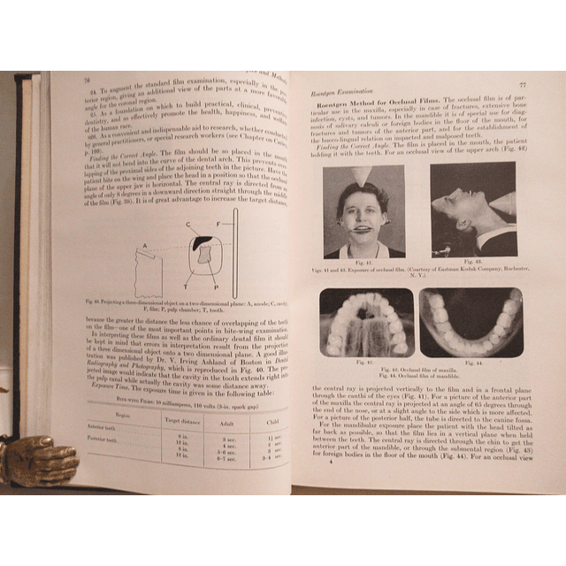 Oral And Dental Diagnosis/With Suggestions for Treatment 1949 Kurt H. Thoma/Henry Goldman