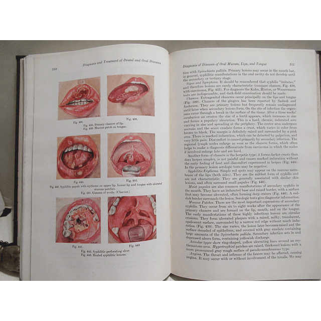 Oral And Dental Diagnosis/With Suggestions for Treatment 1949 Kurt H. Thoma/Henry Goldman