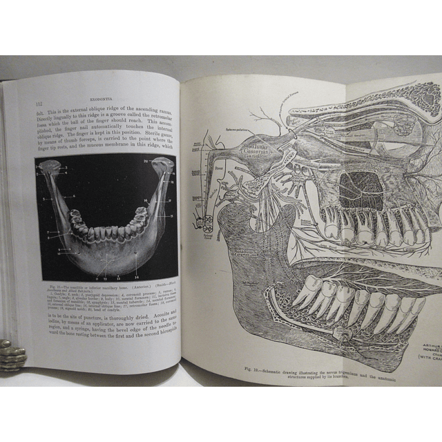 Exodontia, Oral Surgery And Anesthesia 1945 Leo Winter