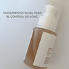 TRATAMIENTO FACIAL CONTROL ACNÉ. VITAMINA B3, ÁCIDO HIALURÓNICO Y TÉ VERDE. 