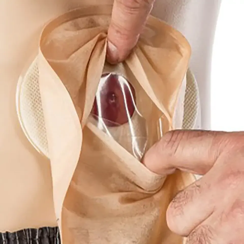 Bolsa Convexa 70mm Colostomia Aurum 2 Welland - Caja 10 unidades - Ostomía 2