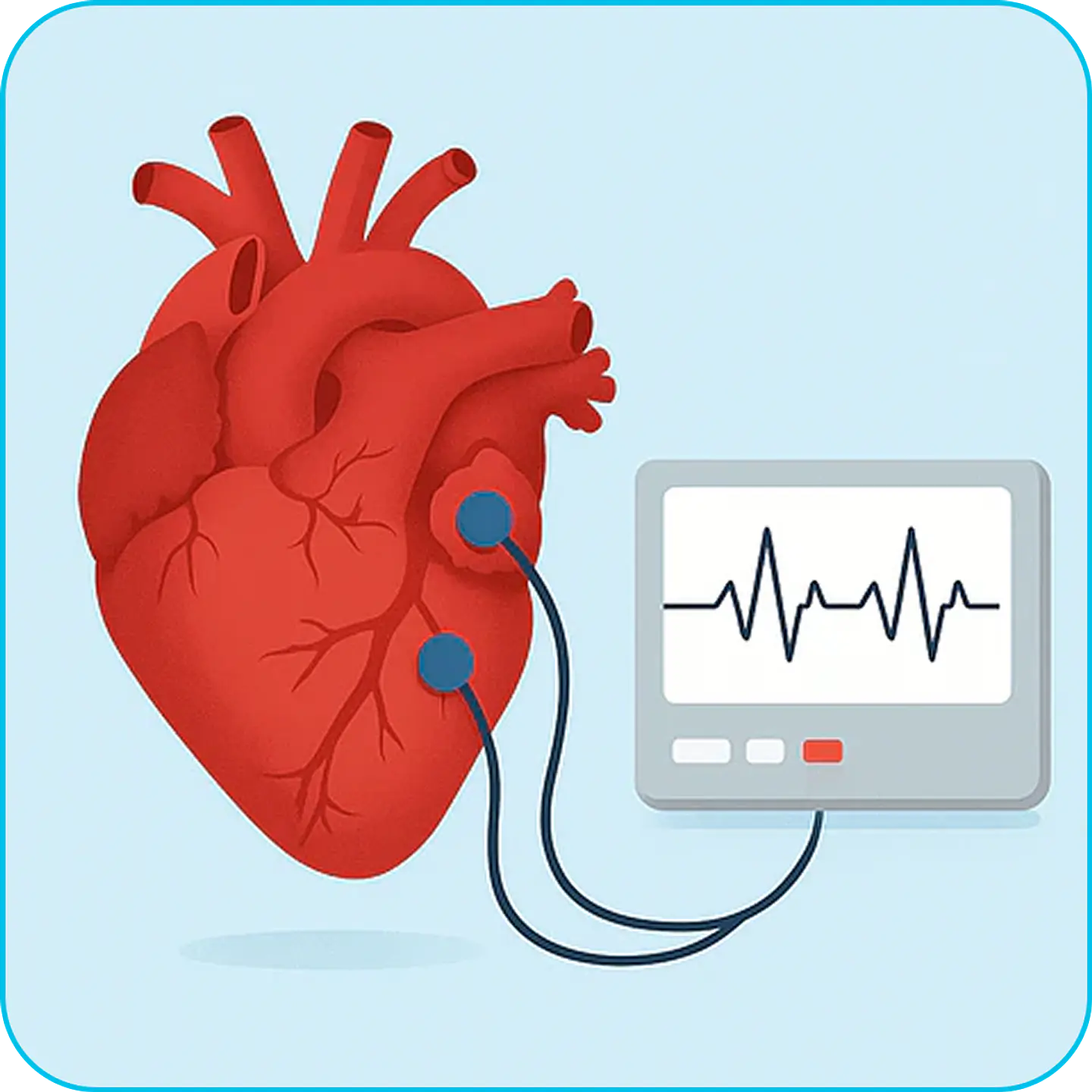ELECTROCARDIOGRAMA 1