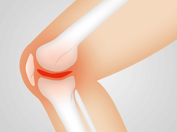 Golden FLX Fuxion: para qué sirve y cómo se toma