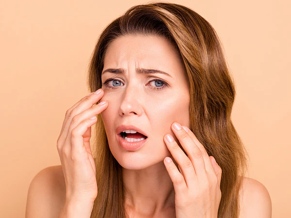 Rugas como tratar e prevenir