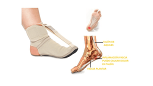 Plantilla para la Fascitis Plantar termo-mecánica cod FXRE