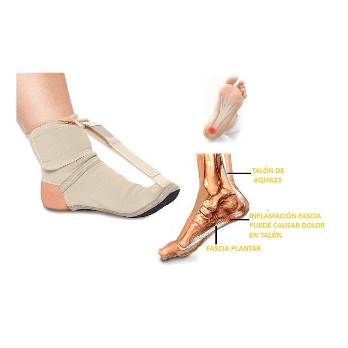 Plantilla para la Fascitis Plantar termo-mecánica cod FXRE 1