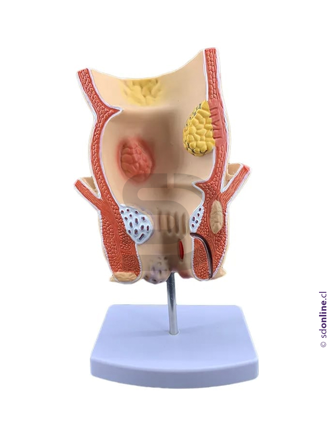 Modelo patología rectal