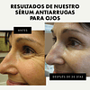 Soro de olhos com retinol, colágeno, aloé vera, vitamina C e E, creme para debaixo dos olhos que ajuda a iluminar as olheiras, reduzir rugas, linhas finas e olhos inchados, 15 ml