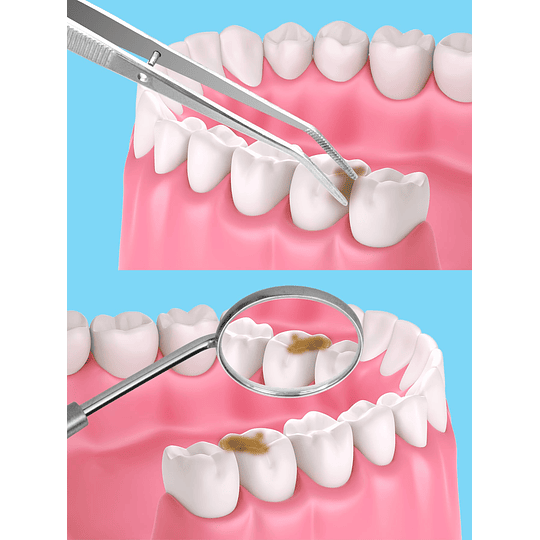 4peças Pincéis de Limpeza Dente