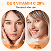 Soro de vitamina C para rosto, soro facial puro com 20% vitamina C, ácido hialurónico vitamina B, para soro anti-idade para rosto, pescoço e contorno de olhos