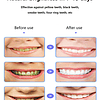 1 Conjunto Abs Branqueamento Dentes Produto , Moderno Dispositivo De Clareamento Dos Dentes Para Higiene Bucal