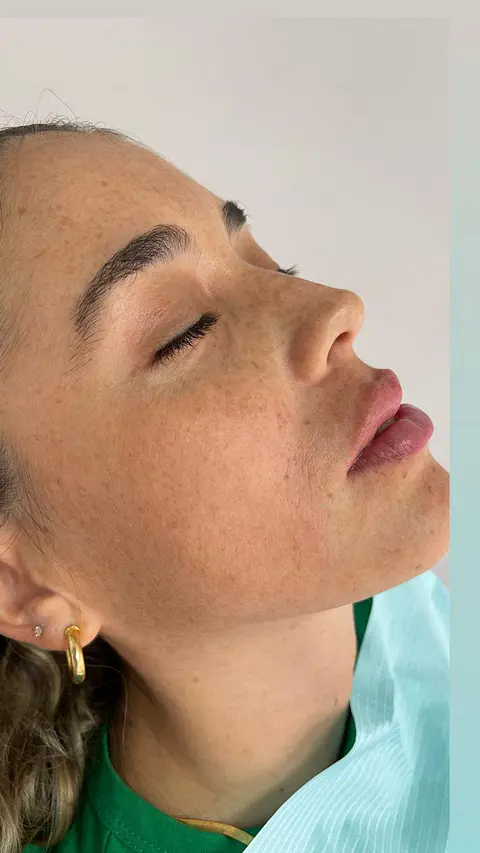 Perfilado labial