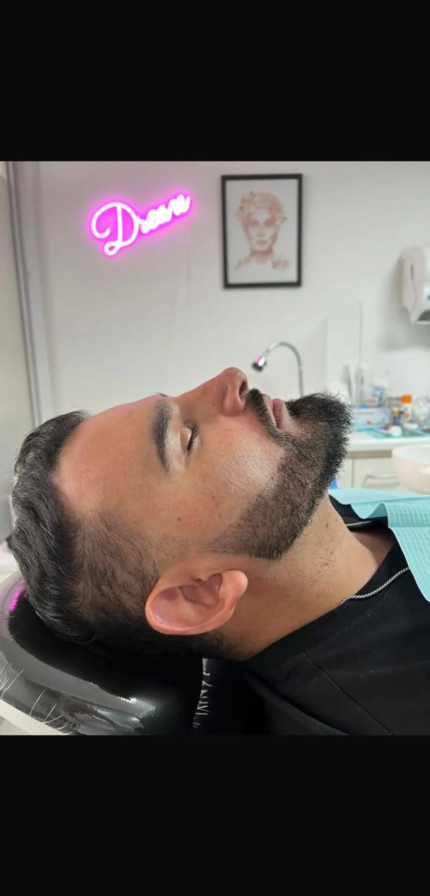 Armonización Facial 2