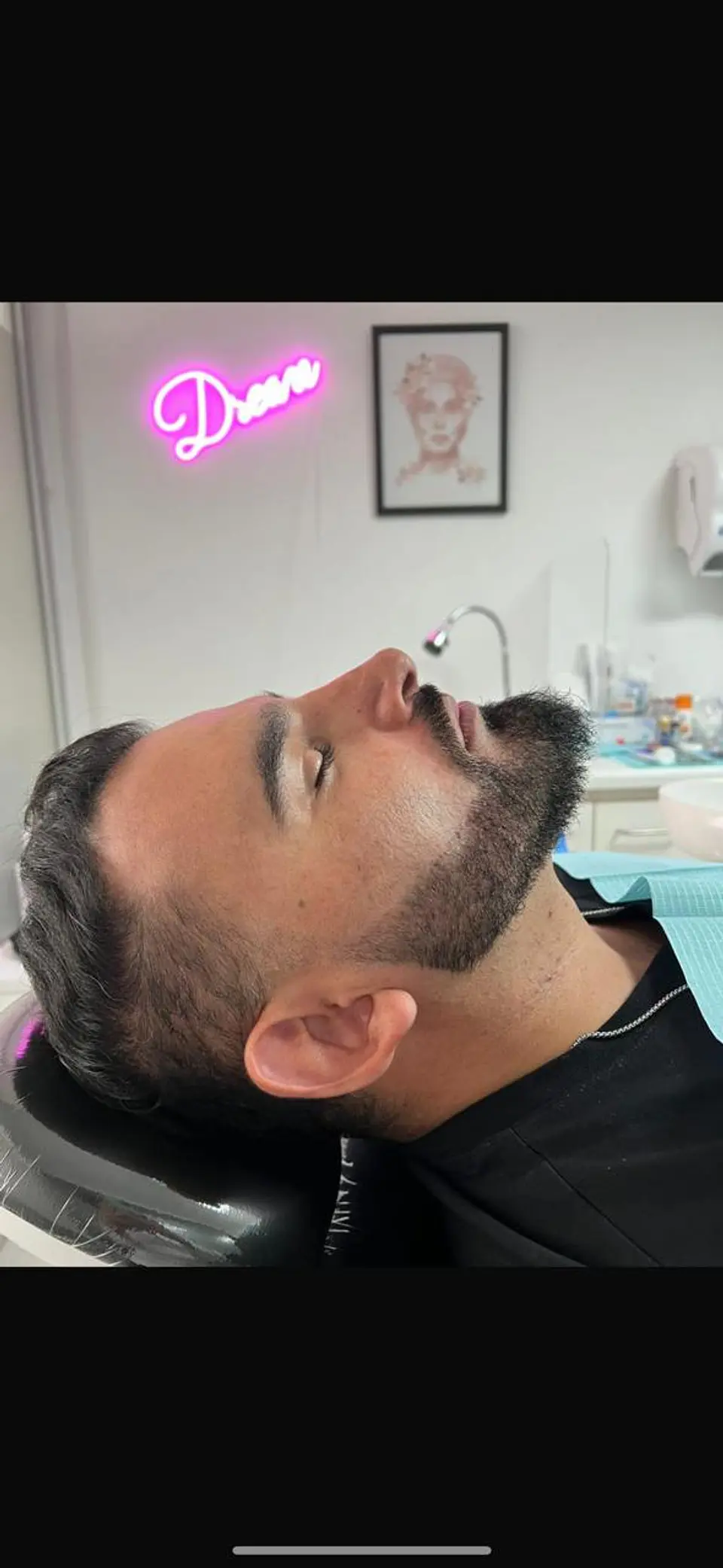 Armonización Facial 2