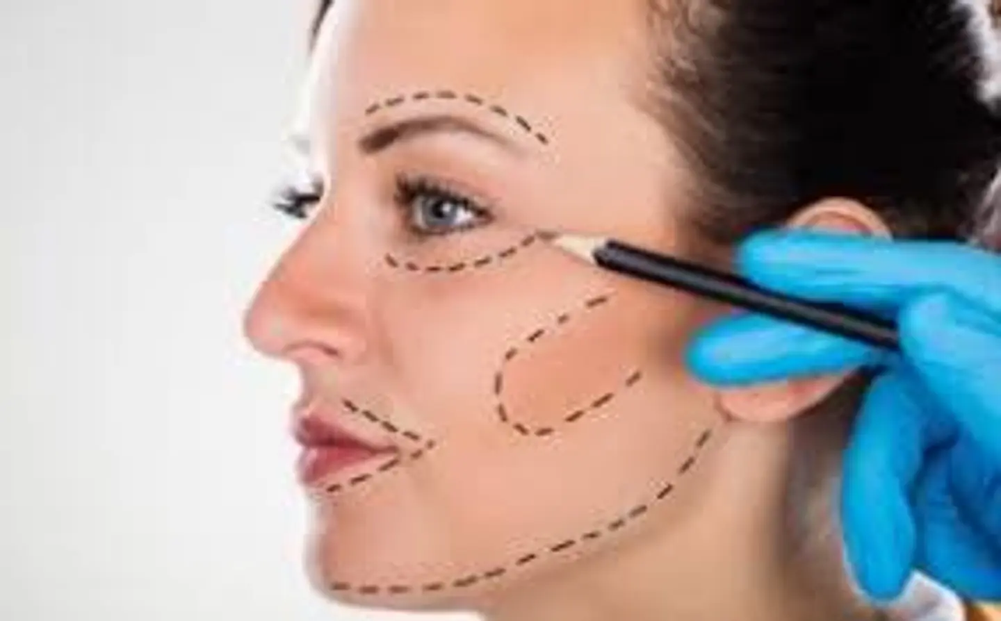 Análisis Estético Facial  1