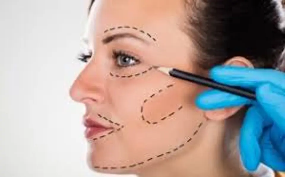 Análisis Estético Facial  1