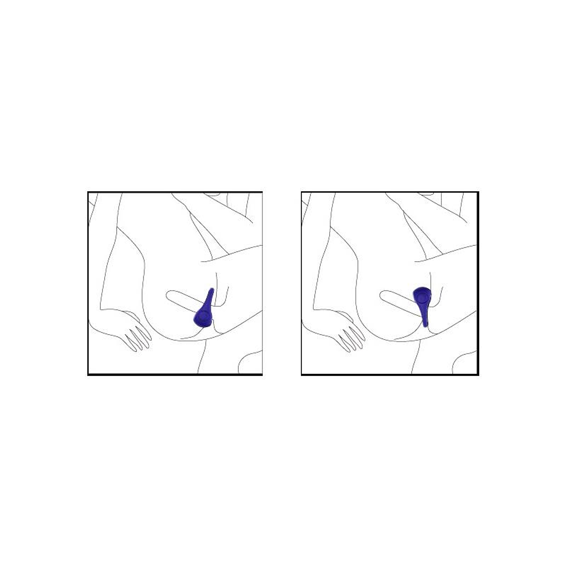 ANEL VIBRATÓRIO NALONE PING  6