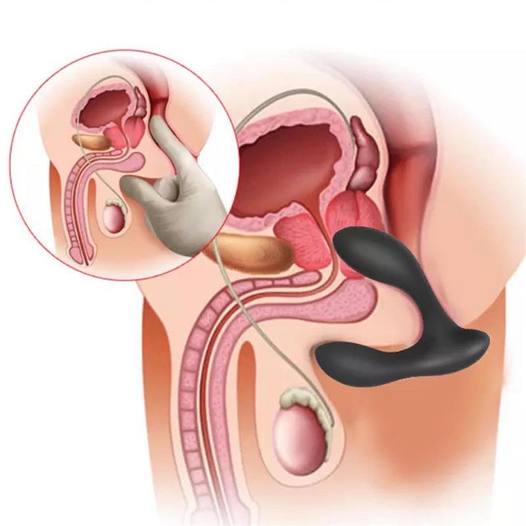  BRETT MASSAJADOR DE PRÓSTATA  8