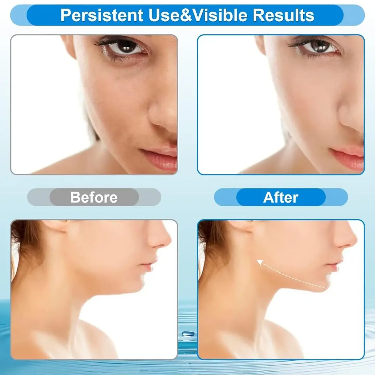 Dispositif de Lifting Facial – Chaleur & EMS 3