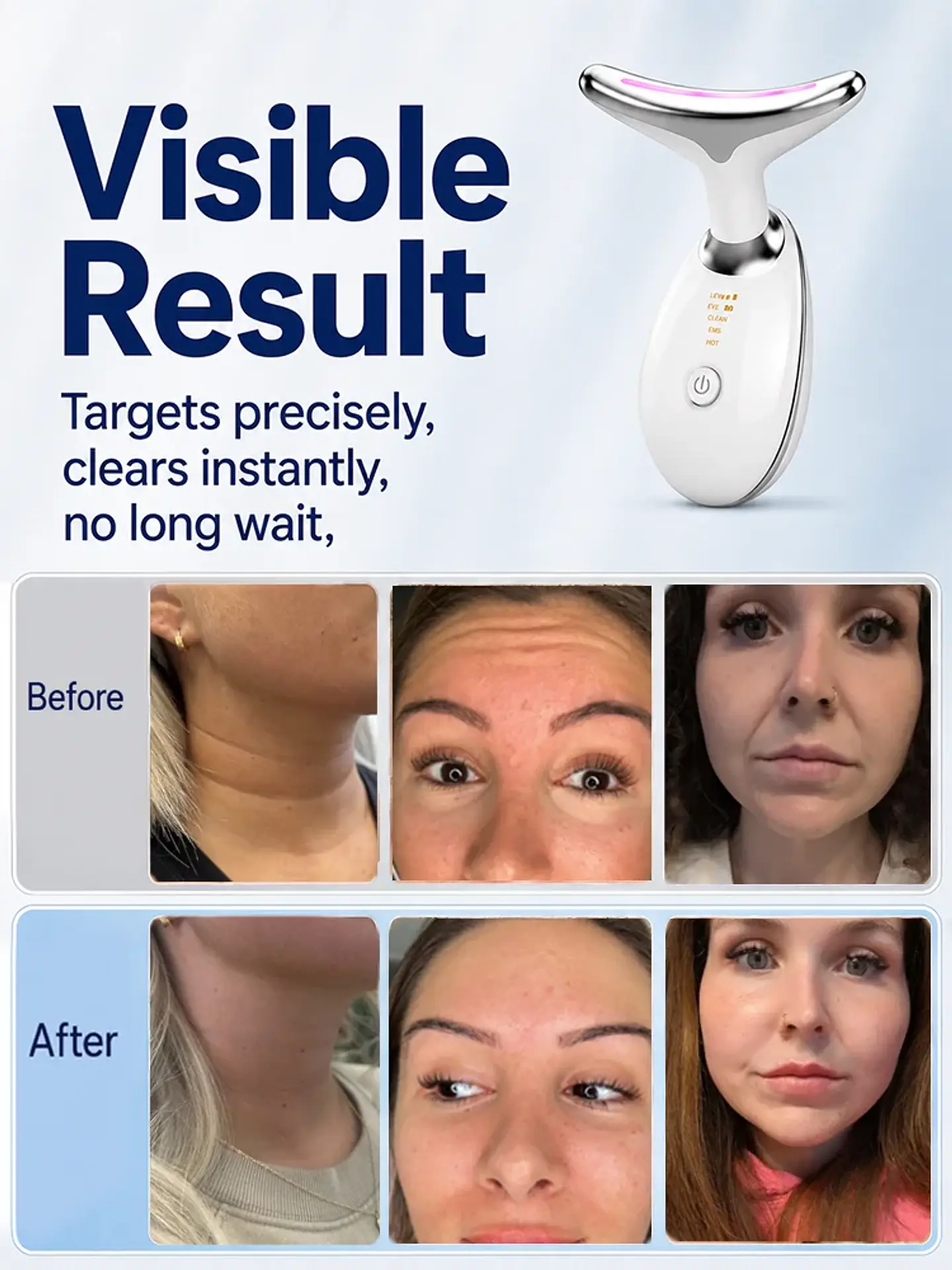 Appareil de Lifting Visage & Cou – EMS & LED 3