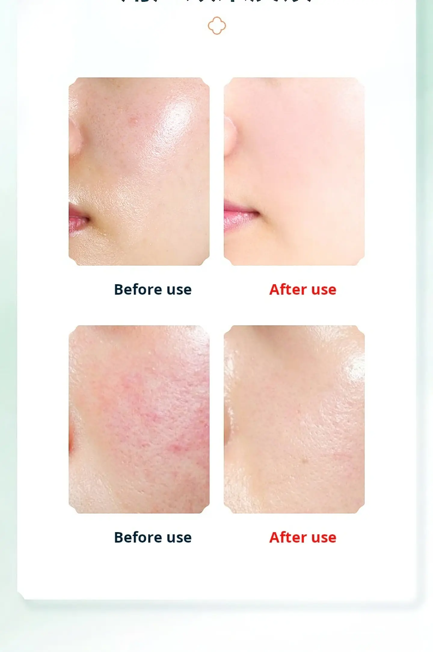 Instrument de Lavage du Visage Électrique – Chauffant 18