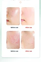 Instrument de Lavage du Visage Électrique – Chauffant - thumbnail 18
