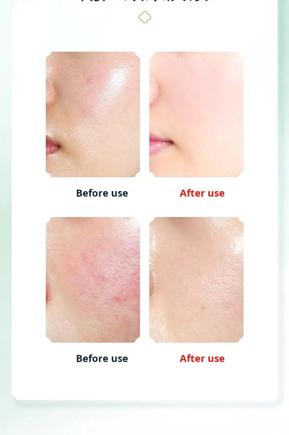 Instrument de Lavage du Visage Électrique – Chauffant 18