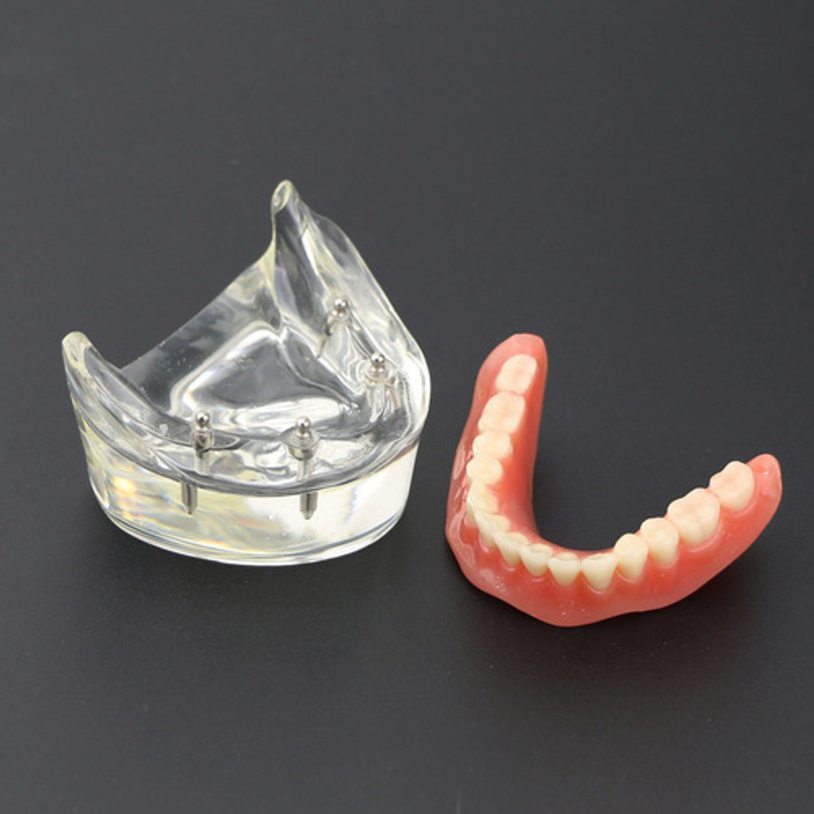 Modelo Sobre Dentadura Implantes Novedad Enseñanza Santiago 2