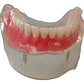 Modelo Sobre Dentadura Implantes Novedad Enseñanza Santiago - Miniatura 3