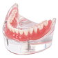 Modelo Sobre Dentadura Implantes Novedad Enseñanza Santiago - Miniatura 4