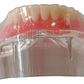 Modelo Sobre Dentadura Implantes Novedad Enseñanza Santiago - Miniatura 6