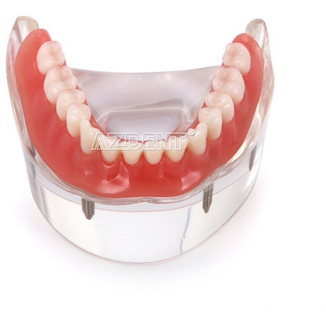 Modelo Sobre Dentadura Implantes Novedad Enseñanza Santiago 8