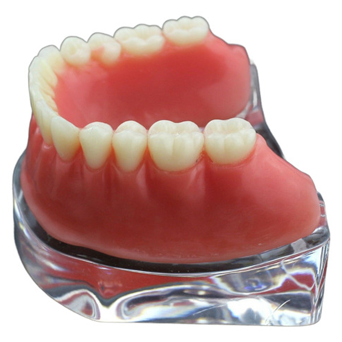 Modelo Sobre Dentadura Implantes Novedad Enseñanza Santiago 10