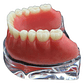Modelo Sobre Dentadura Implantes Novedad Enseñanza Santiago - Miniatura 10