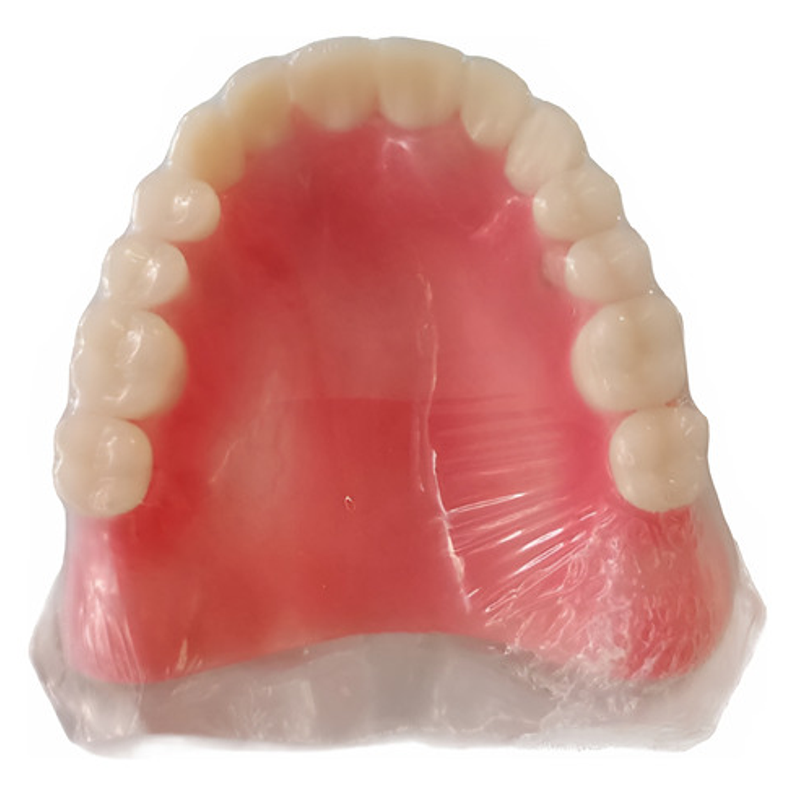 Modelo Sobre Dentadura Implantes Novedad Enseñanza Santiago 12