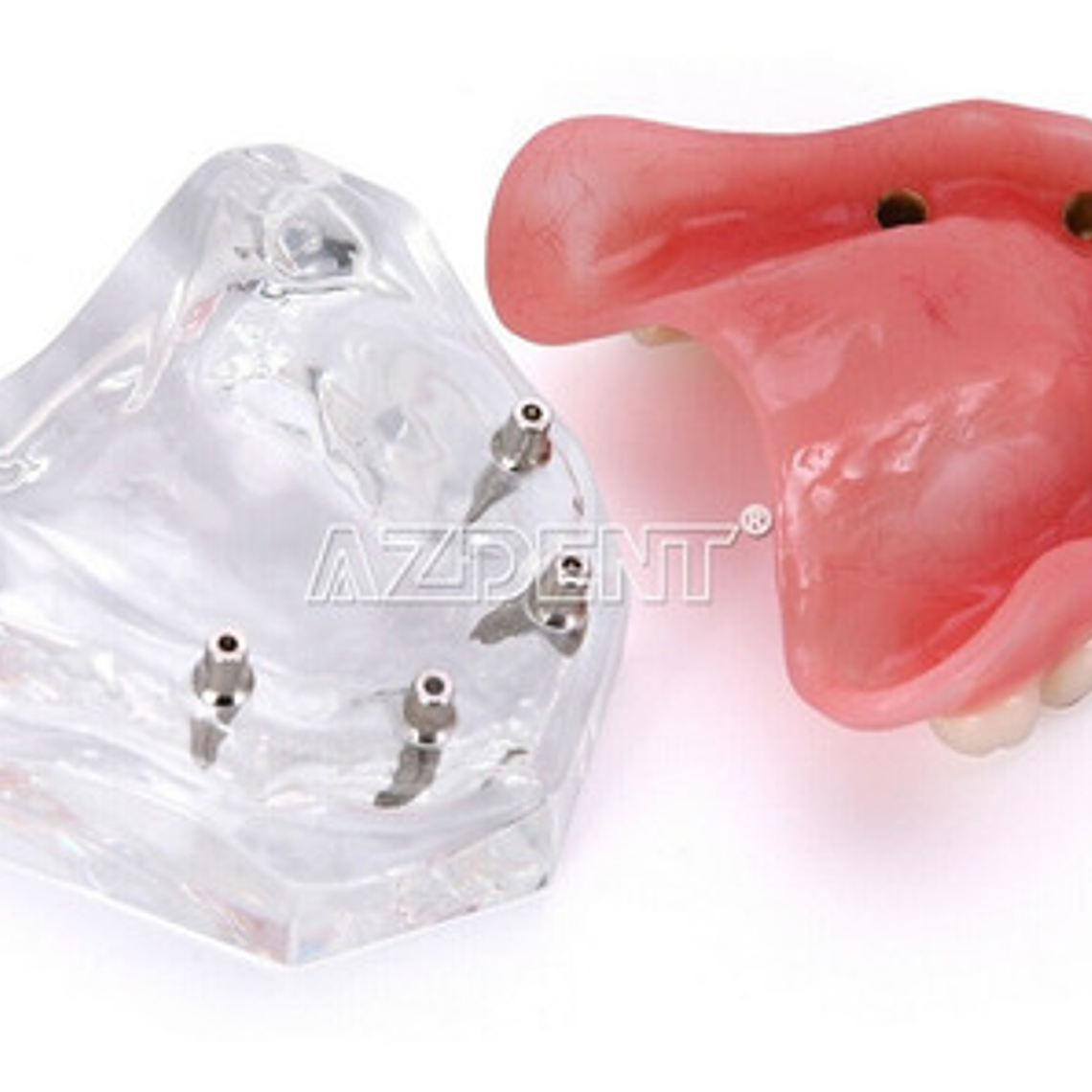 Modelo Sobre Dentadura Implantes Novedad Enseñanza Santiago 14