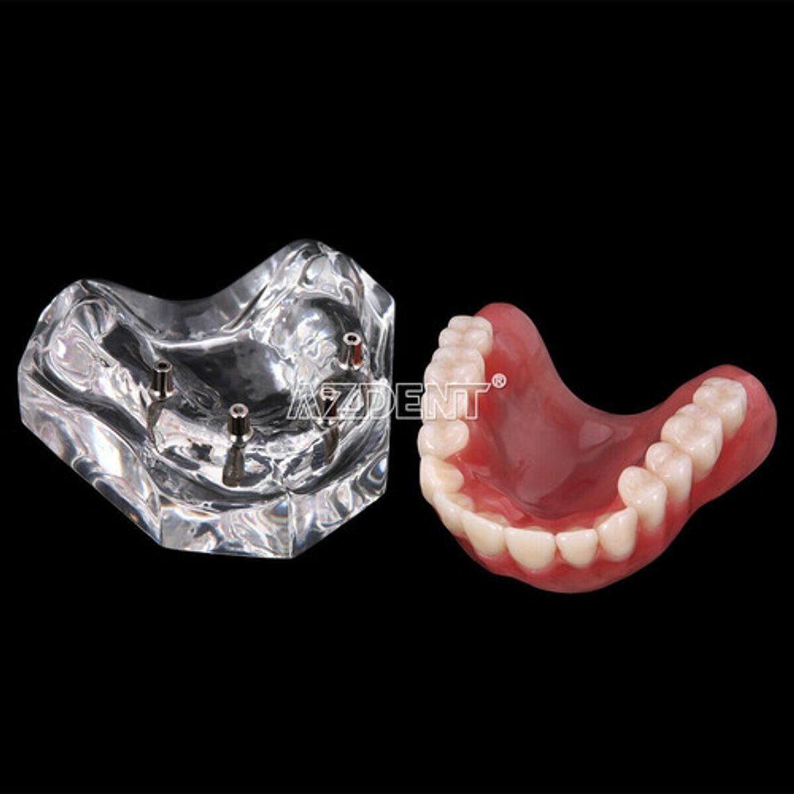 Modelo Sobre Dentadura Implantes Novedad Enseñanza Santiago 15