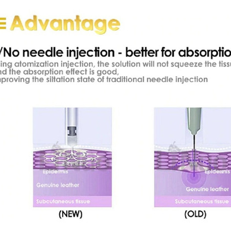 Hyaluron Pen Lápiz Hialurónico Alta Presión Calidad Santiago 5