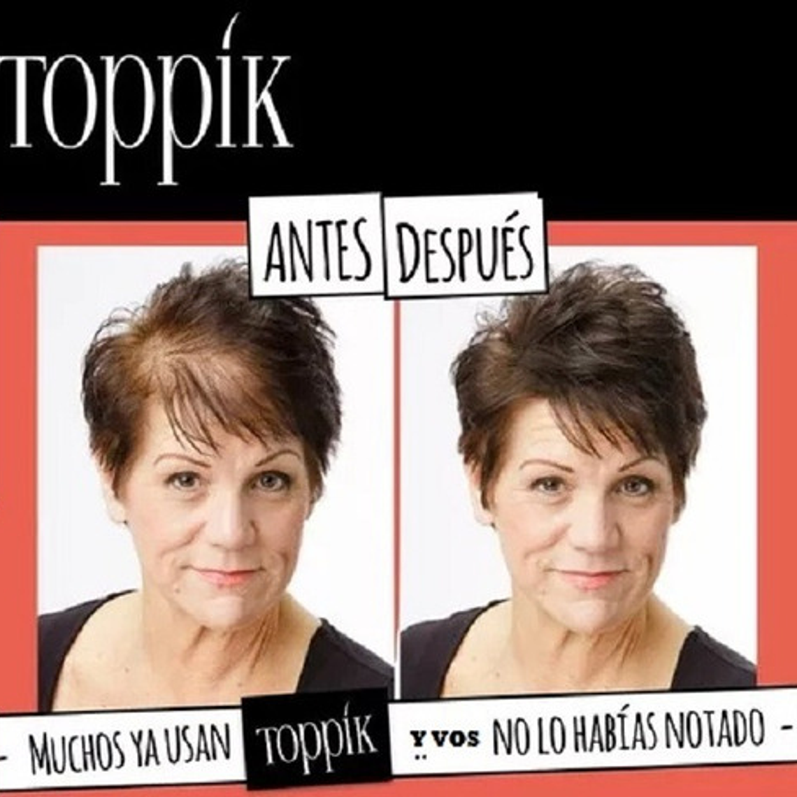 Pack Toppik Microfibras De Queratina + Aplicador Difusor 19