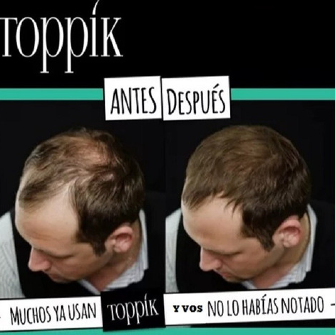 Pack Toppik Microfibras De Queratina + Aplicador Difusor 24