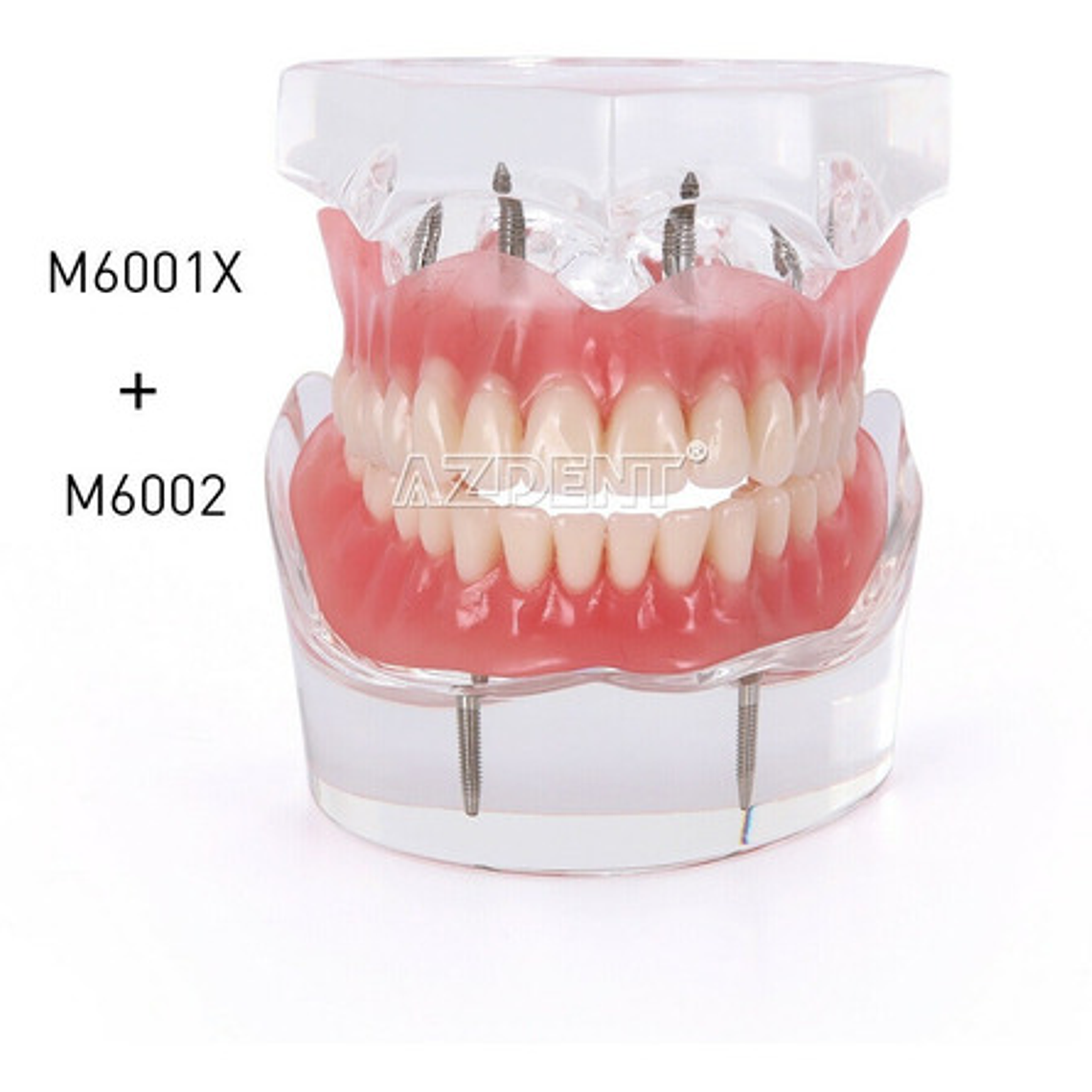 2 Modelos Sobre Dentadura Implantes Enseñanza Santiago 2