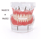 2 Modelos Sobre Dentadura Implantes Enseñanza Santiago - Miniatura 2