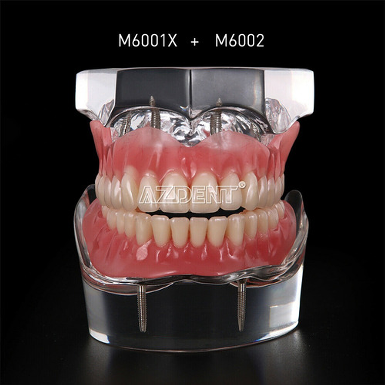 2 Modelos Sobre Dentadura Implantes Enseñanza Santiago 3